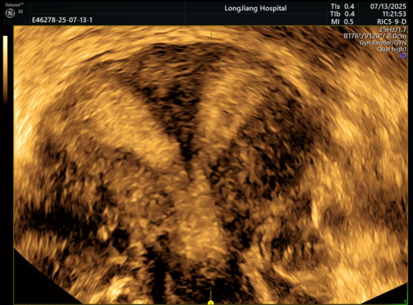 配资炒股最新 探秘“宝宝宫殿”的魔法相机！宫腔三维超声检查